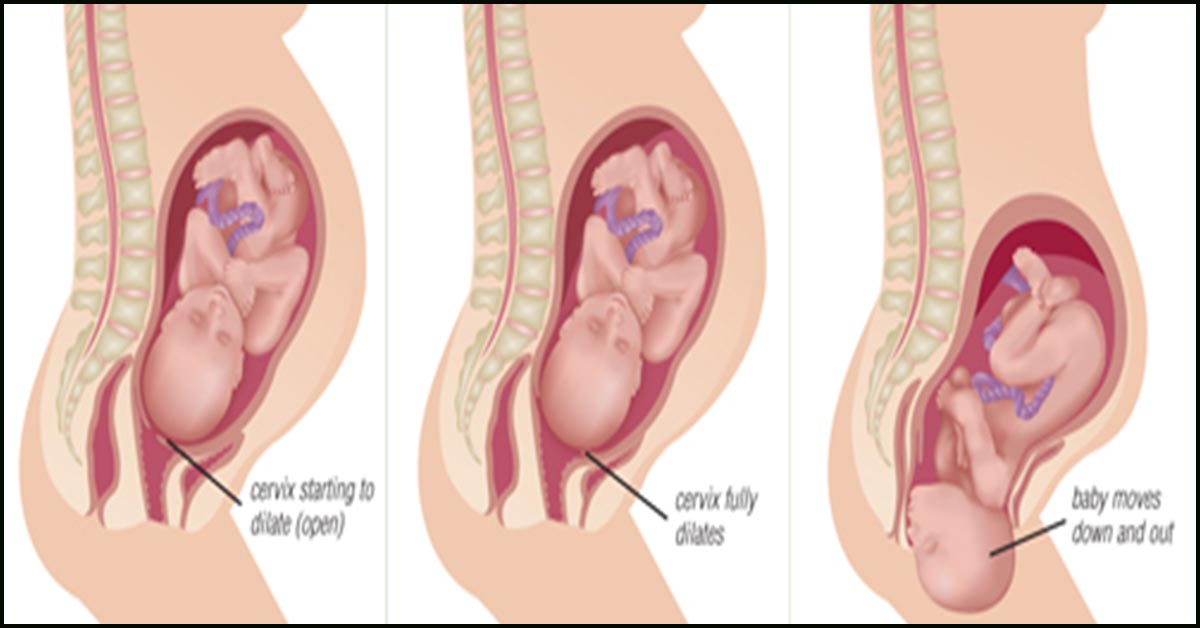 Juno reccomend The ideal position of a fetus for a vaginal delivery