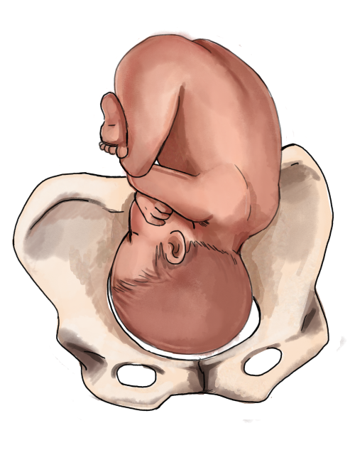 Egg T. reccomend The ideal position of a fetus for a vaginal delivery