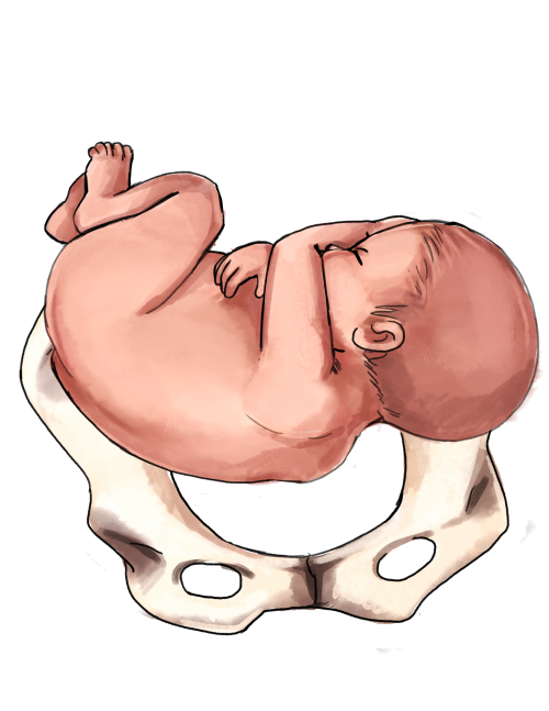 The ideal position of a fetus for a vaginal delivery