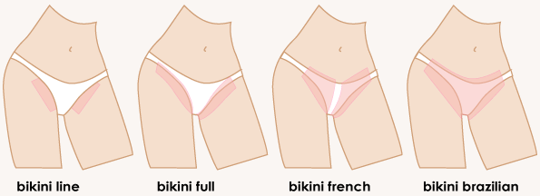 Apple reccomend Bikini brazilian line