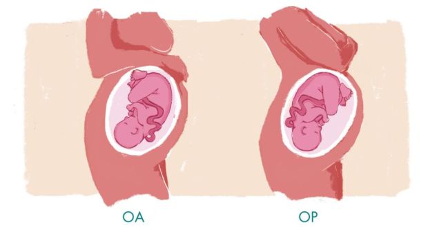 best of Ideal of vaginal fetus position for a delivery The a