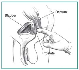 Number S. reccomend Weak orgasm after cystoscopy